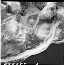 Szapocznikow, Alina, Pogrzeb Aliny - fragment, 1970, poliester, wata szklana